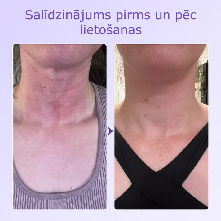 Neride – Peptīdu Kakla Pretgrumbu Plāksteris