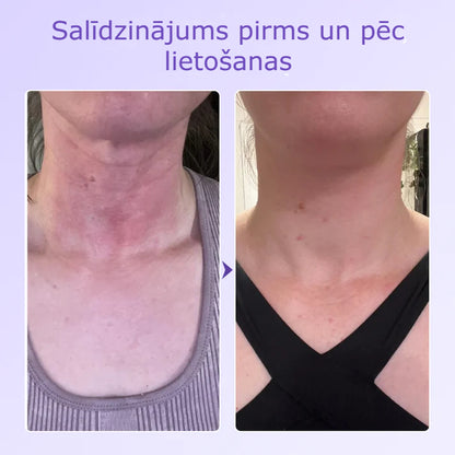 Neride – Peptīdu Kakla Pretgrumbu Plāksteris