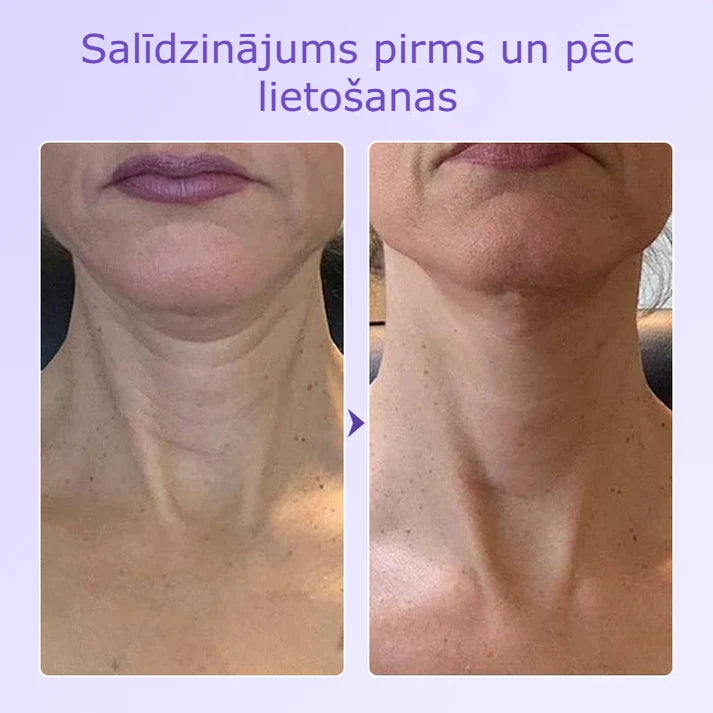 Neride – Peptīdu Kakla Pretgrumbu Plāksteris